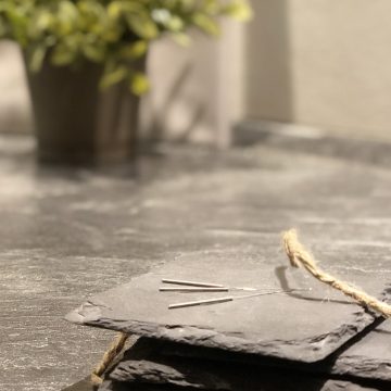 Akupunktur Akupunktur