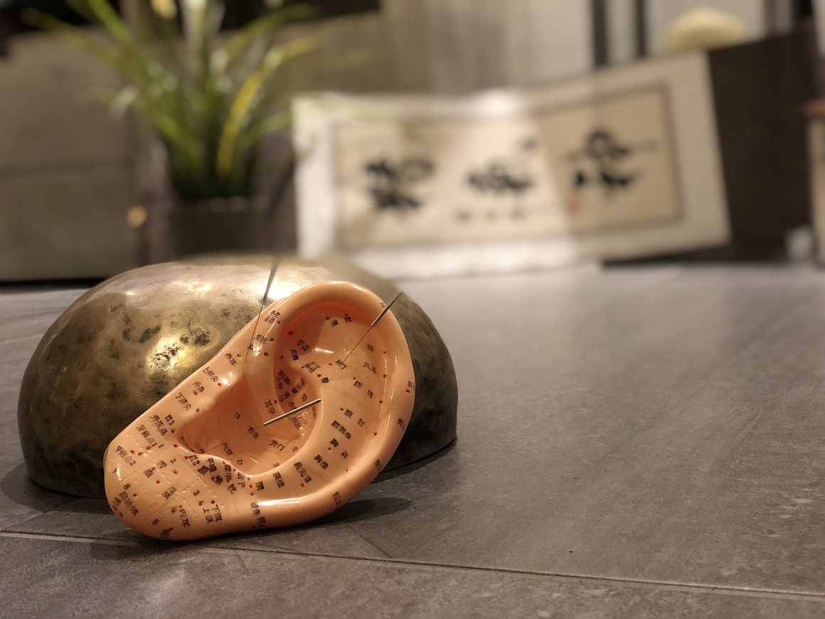 Ohrakupunktur Ohrakupunktur