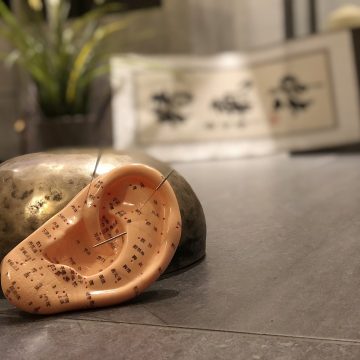Ohrakupunktur Ohrakupunktur